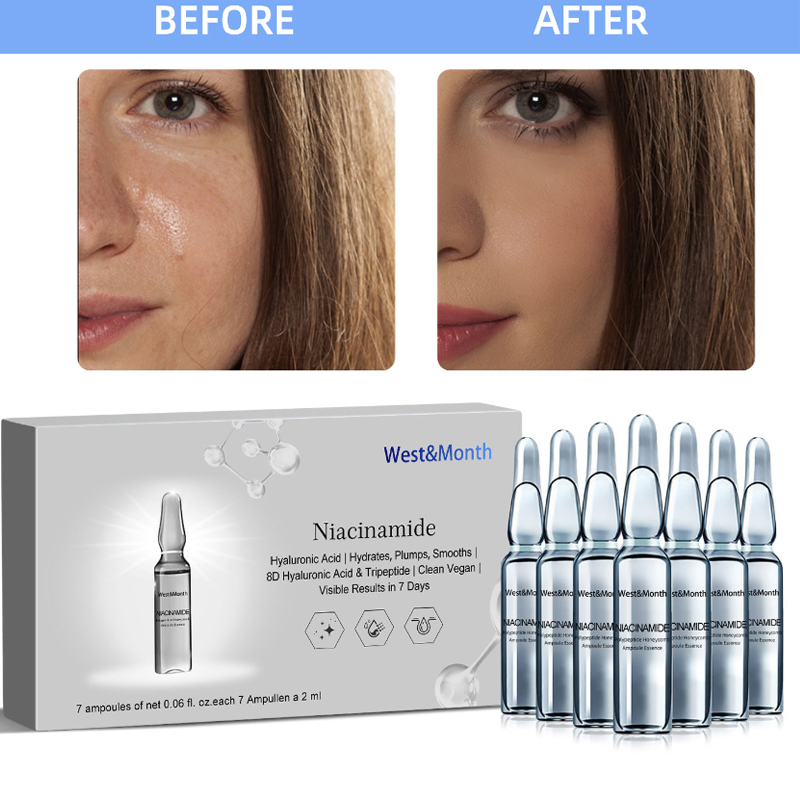 7ml*7pcs Hyaluronsäure Meso Fa – Hyaluronic Acid Facial Serum Bewertung und Preis