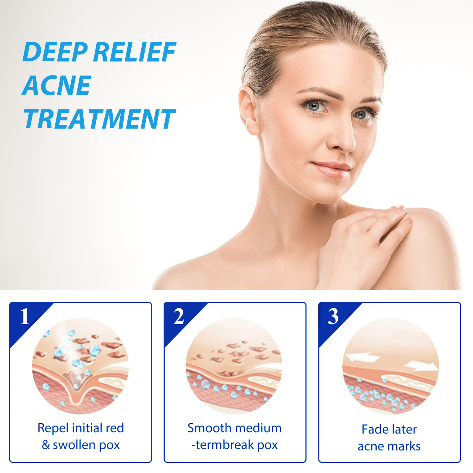 EELHOE Akne-Behandlungslotion, – Salicylic Acid Blackhead Remover Bewertung und Preis